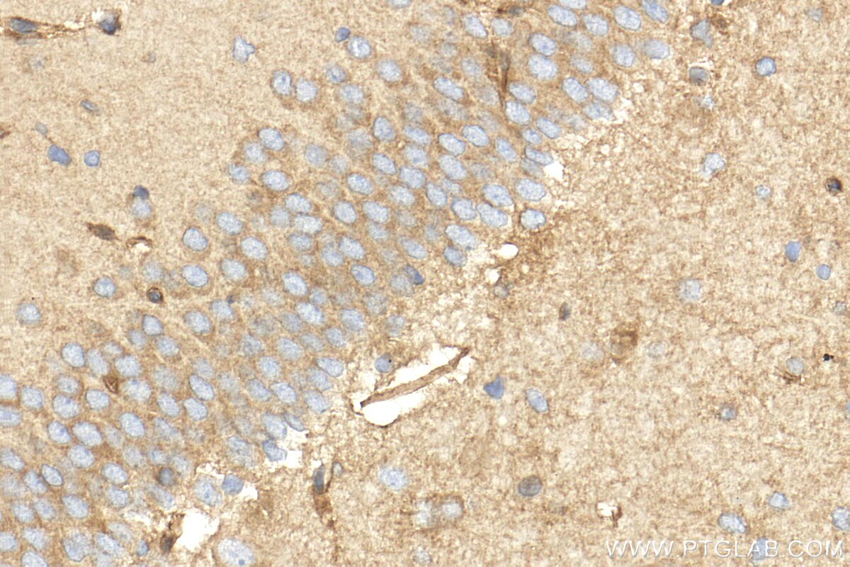Immunohistochemistry (IHC) staining of rat brain tissue using KCNH1 Polyclonal antibody (26426-1-AP)