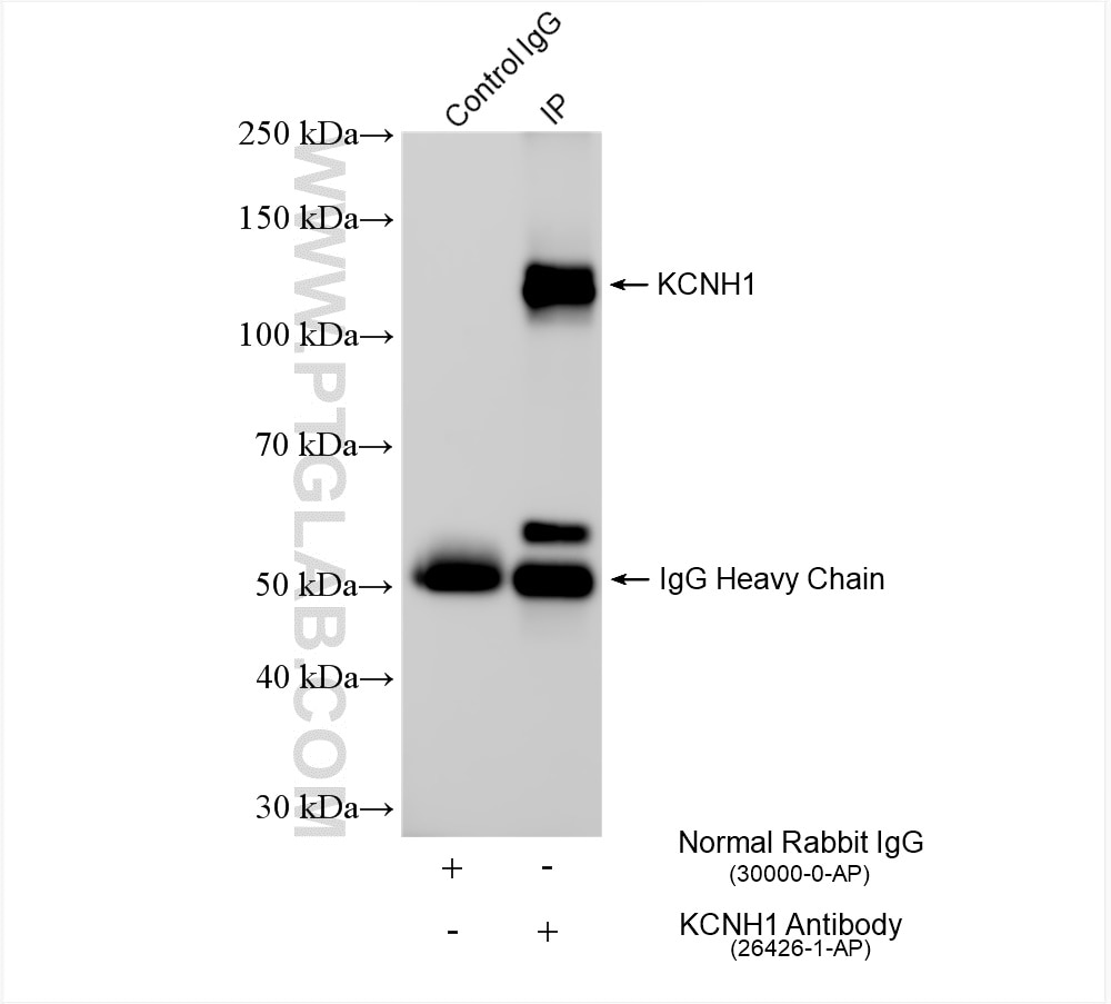 Immunoprecipitation (IP) experiment of rat brain tissue using KCNH1 Polyclonal antibody (26426-1-AP)
