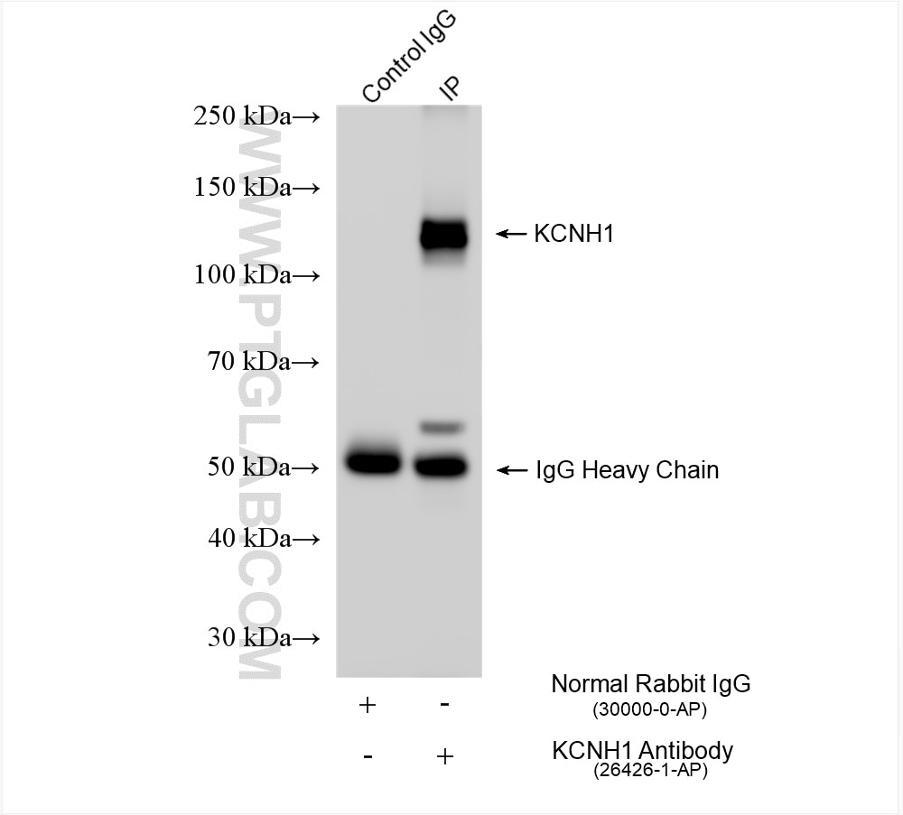 Immunoprecipitation (IP) experiment of mouse brain tissue using KCNH1 Polyclonal antibody (26426-1-AP)