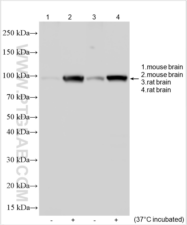 KCNH1
