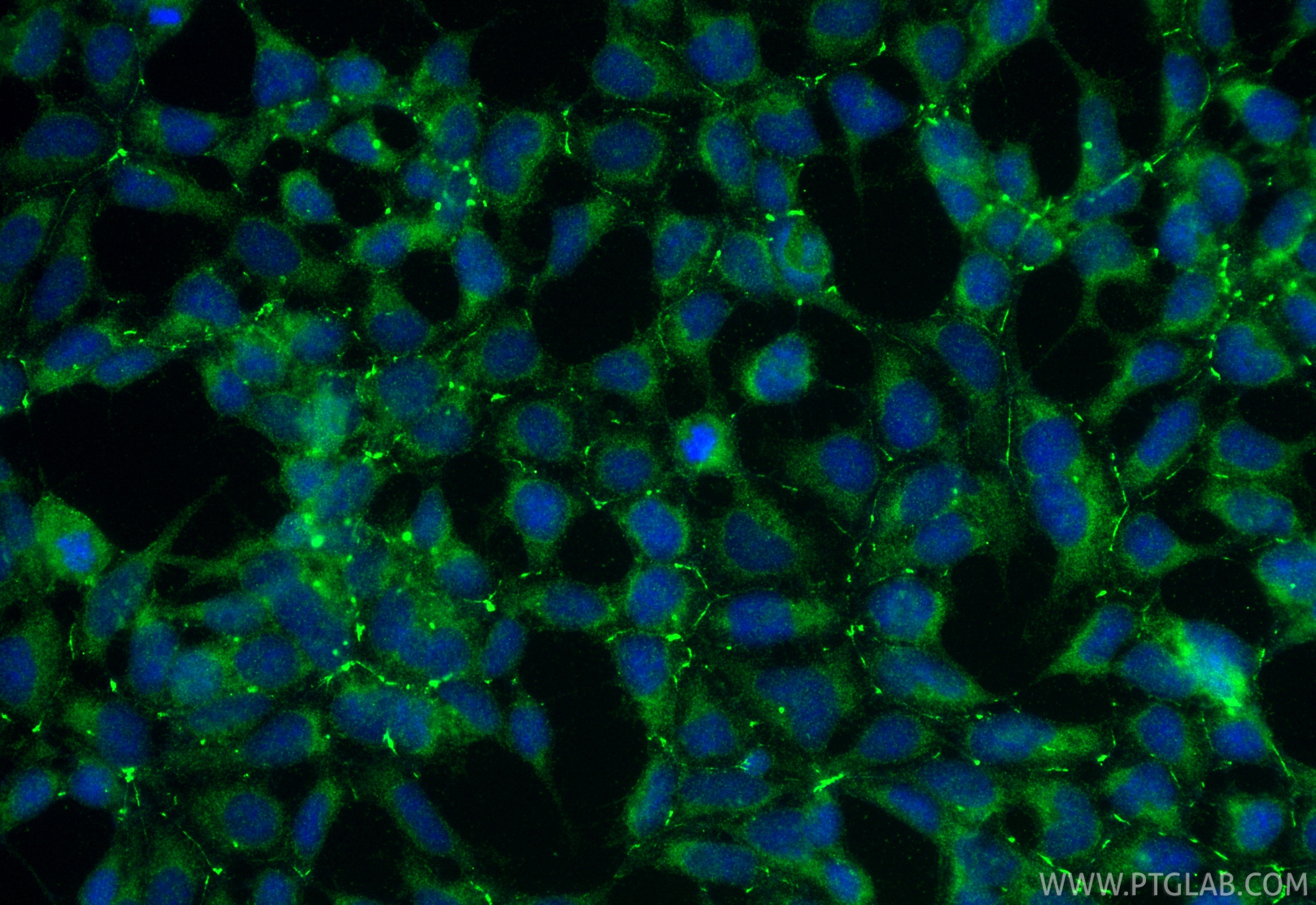 IF Staining of HEK-293 using 30853-1-AP Immunofluorescence (IF) / fluorescent staining of HEK-293 cells using KCNH2 Polyclonal antibody (30853-1-AP)
