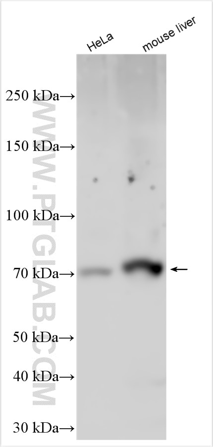 Western Blot (WB) analysis of various lysates using KCNH5 Polyclonal antibody (17912-1-AP)
