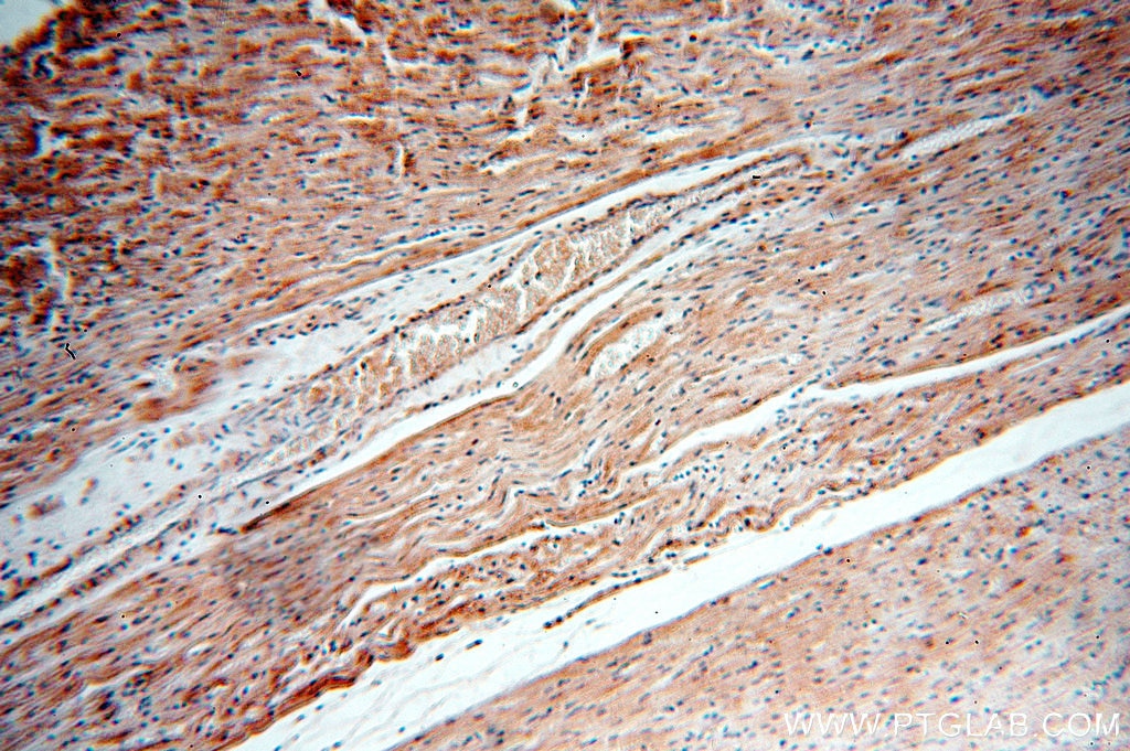 Immunohistochemistry (IHC) staining of human heart tissue using KCNH7 Polyclonal antibody (13622-1-AP)