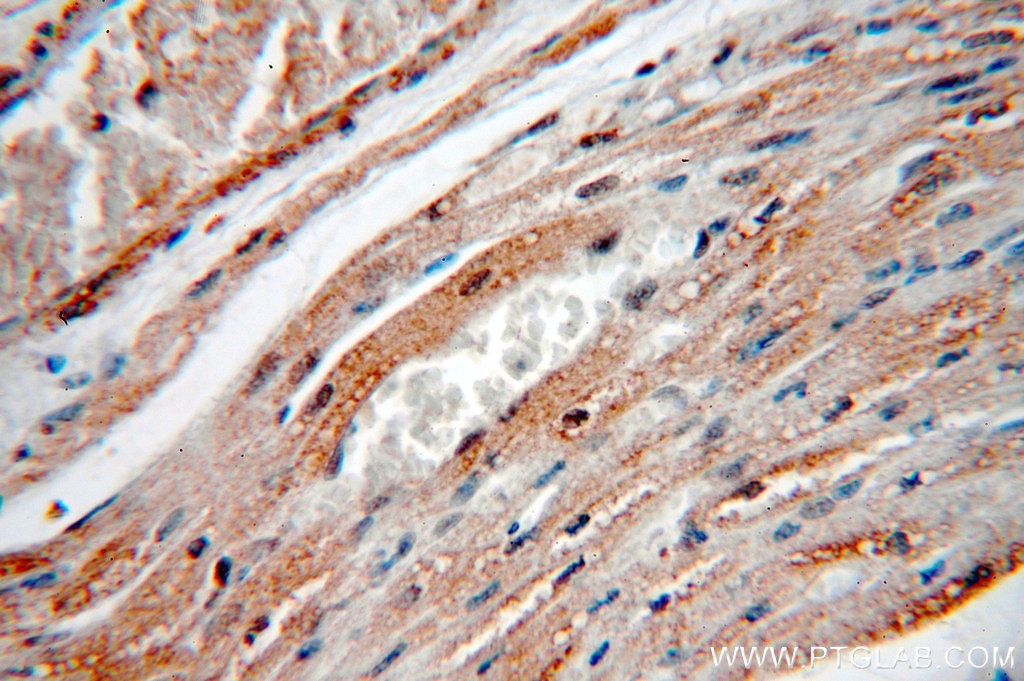 Immunohistochemistry (IHC) staining of human heart tissue using KCNH7 Polyclonal antibody (13622-1-AP)