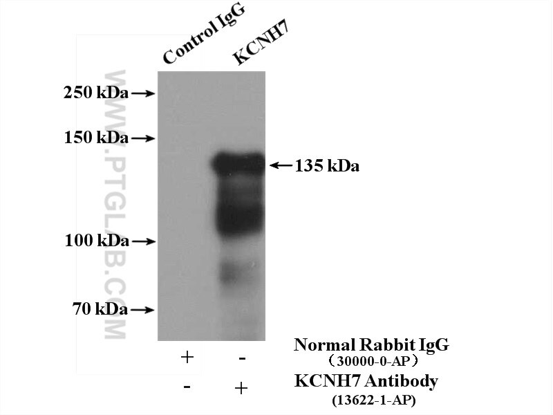 KCNH7