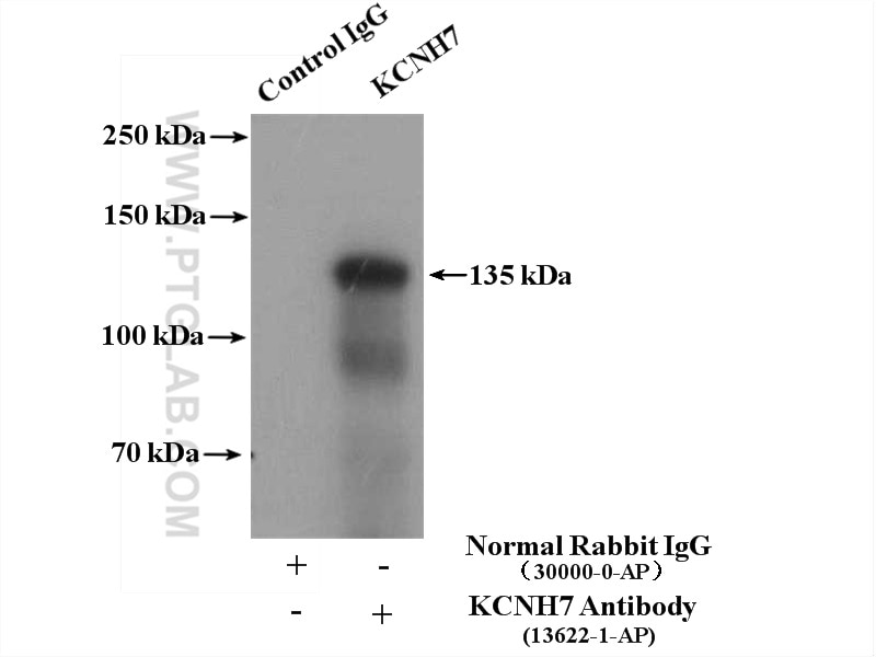 Immunoprecipitation (IP) experiment of mouse brain tissue using KCNH7 Polyclonal antibody (13622-1-AP)