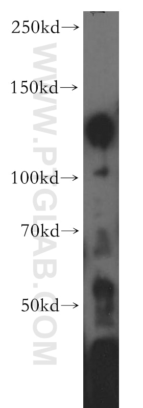 Western Blot (WB) analysis of mouse brain tissue using KCNH7 Polyclonal antibody (13622-1-AP)