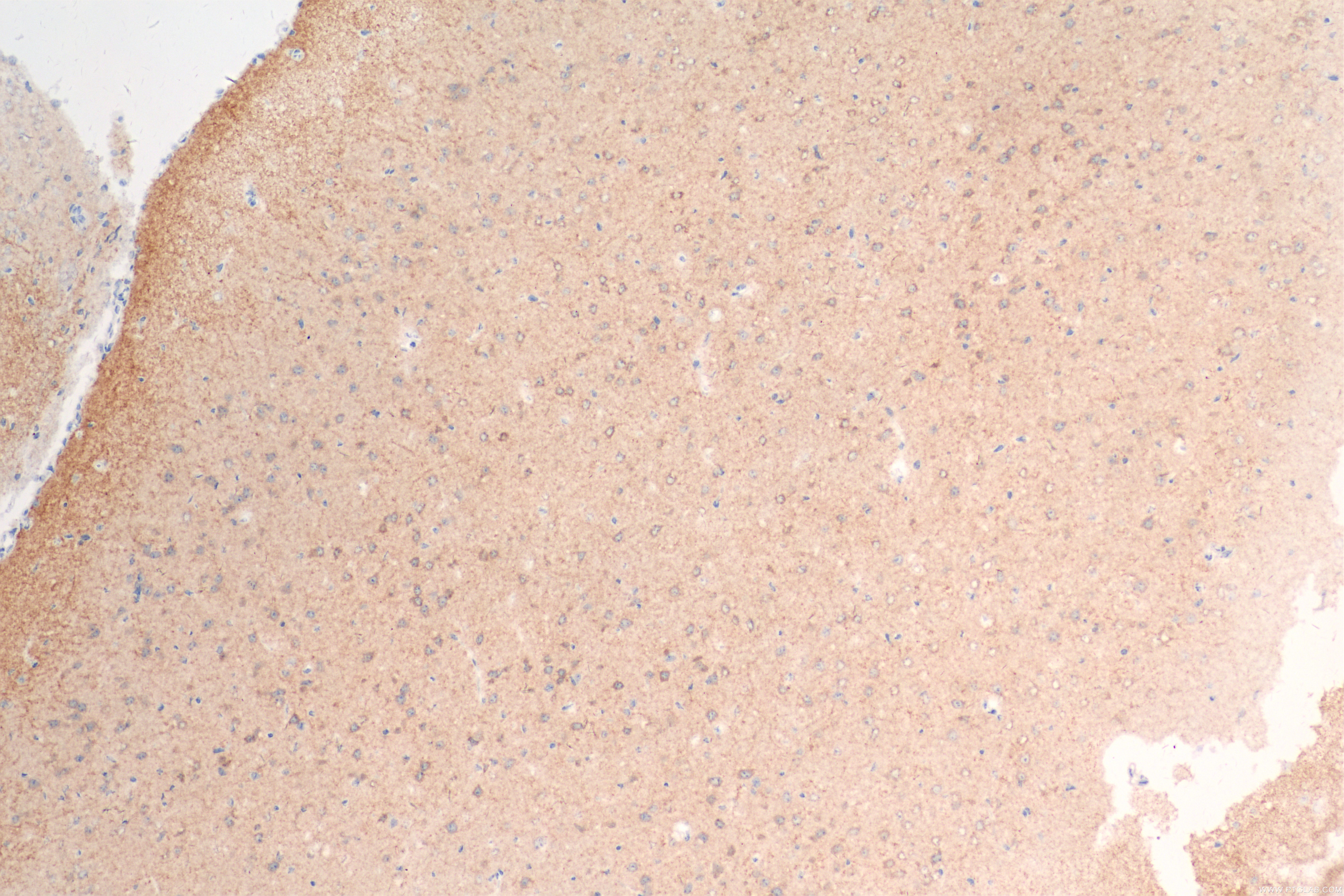 Immunohistochemistry (IHC) staining of mouse brain tissue using KCNH7 Recombinant antibody (83674-1-RR)
