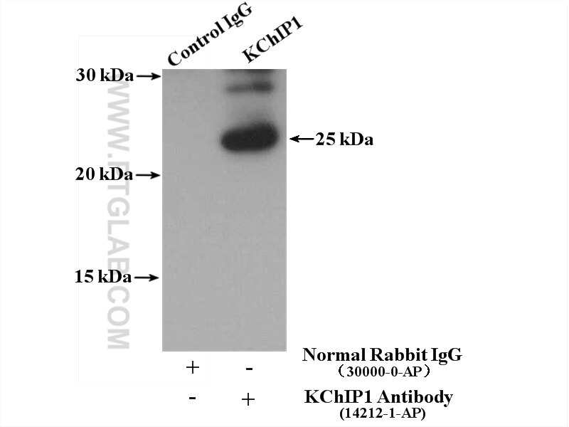 Immunoprecipitation (IP) experiment of fetal human brain tissue using KChIP1 Polyclonal antibody (14212-1-AP)