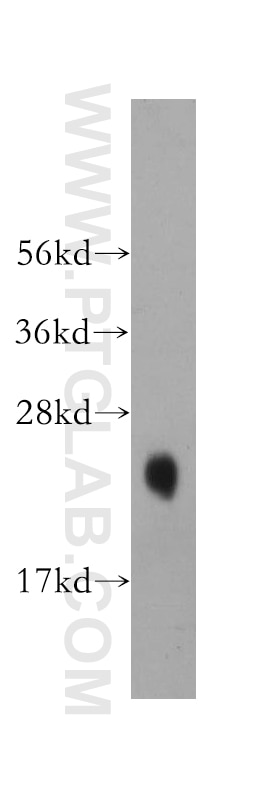 Western Blot (WB) analysis of human cerebellum tissue using KChIP1 Polyclonal antibody (14212-1-AP)