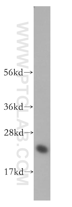 WB analysis of human brain using 14212-1-AP