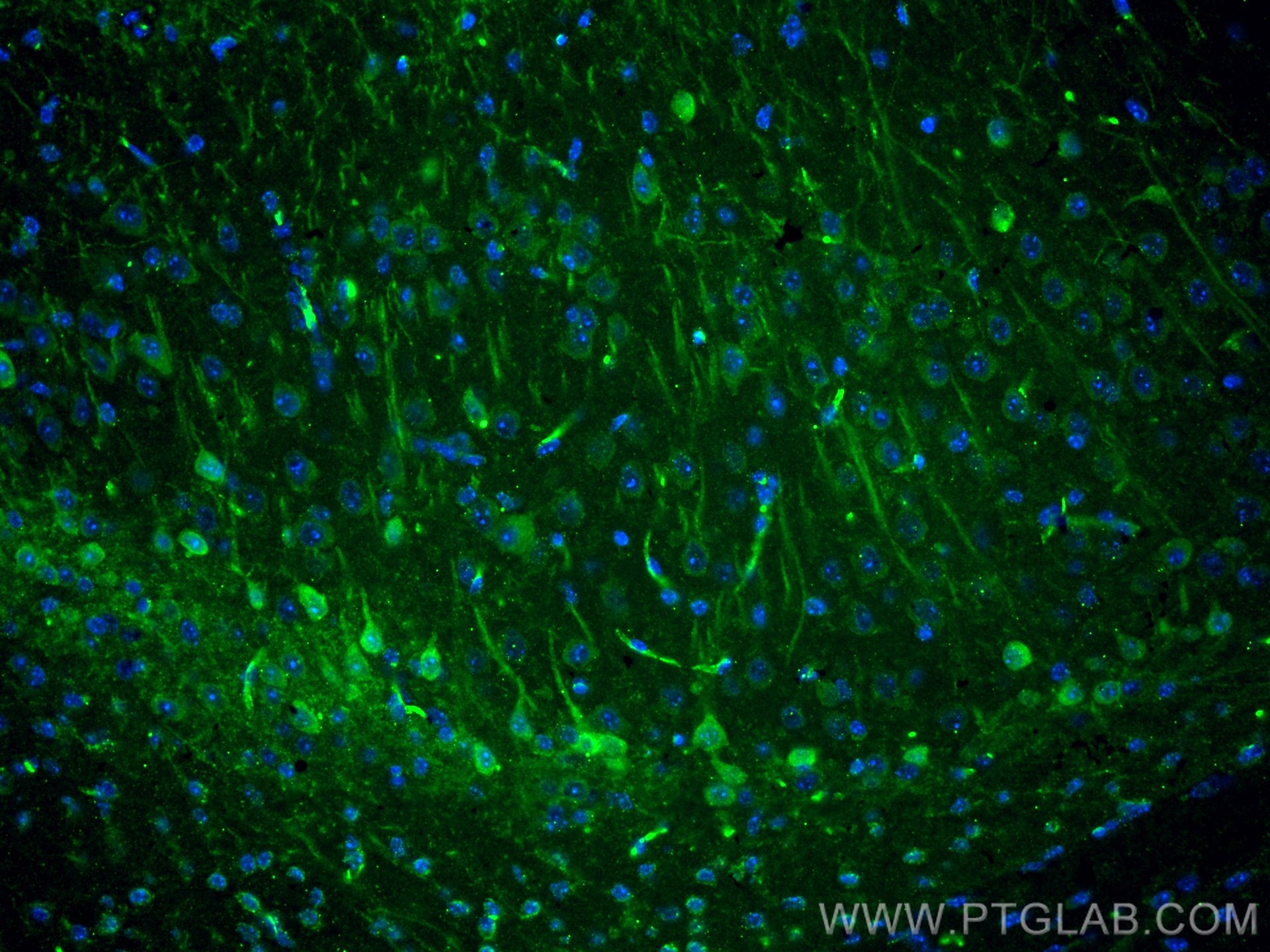 Immunofluorescence (IF) / fluorescent staining of mouse brain tissue using KChIP1 Monoclonal antibody (66439-1-Ig)