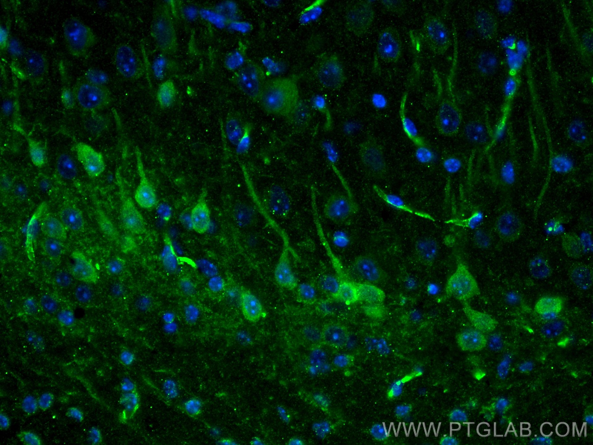 Immunofluorescence (IF) / fluorescent staining of mouse brain tissue using KChIP1 Monoclonal antibody (66439-1-Ig)