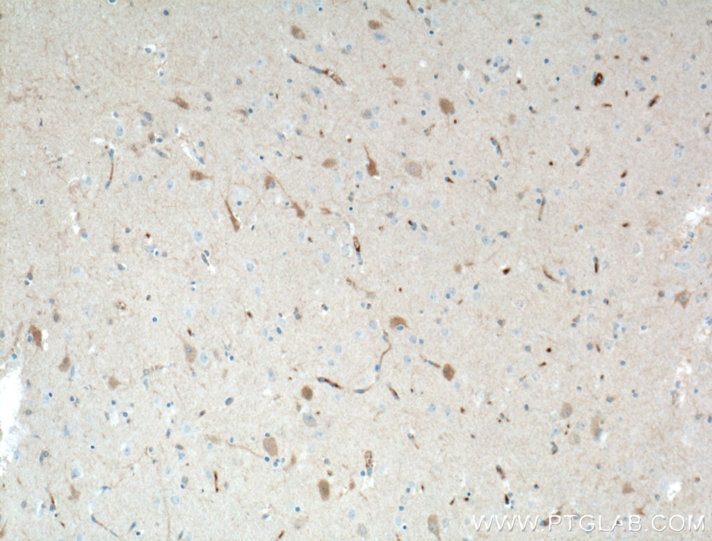 Immunohistochemistry (IHC) staining of human brain tissue using KChIP1 Monoclonal antibody (66439-1-Ig)