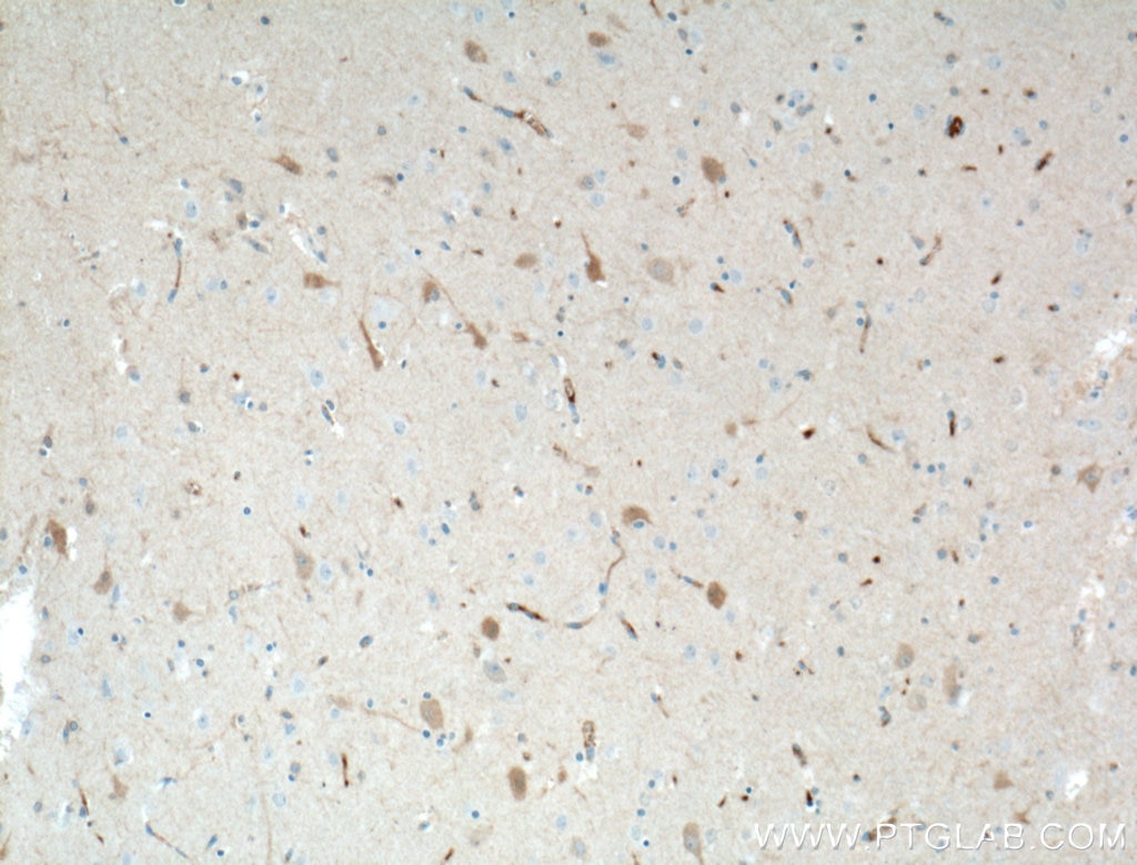 Immunohistochemistry (IHC) staining of human brain tissue using KChIP1 Monoclonal antibody (66439-1-Ig)