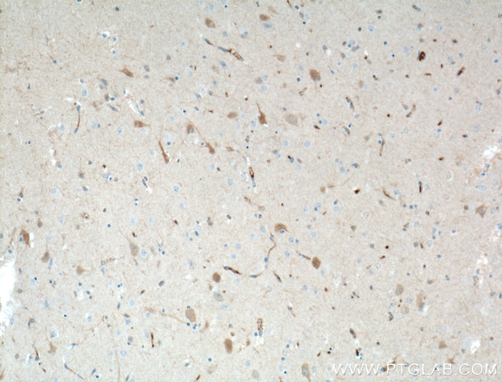 IHC staining of human brain using 66439-1-Ig