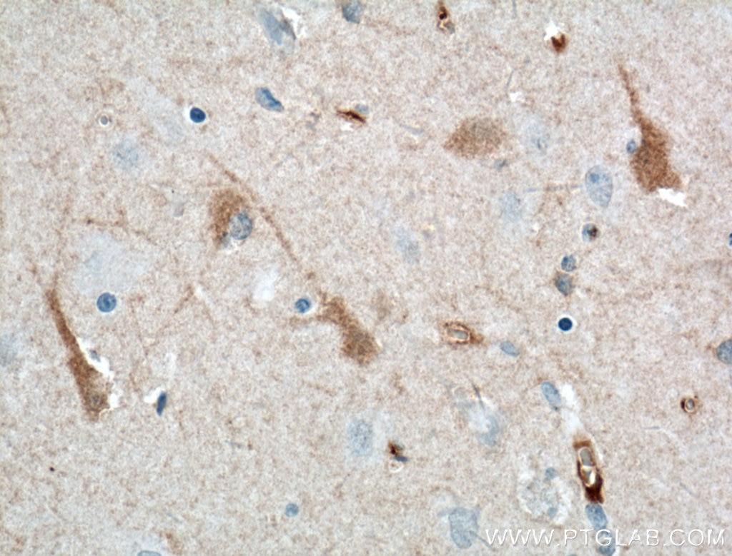IHC staining of human brain using 66439-1-Ig