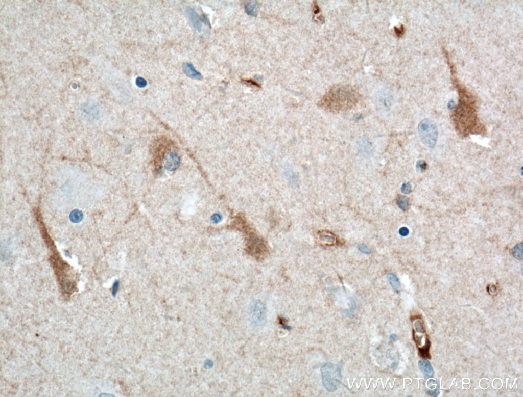 Immunohistochemistry (IHC) staining of human brain tissue using KChIP1 Monoclonal antibody (66439-1-Ig)