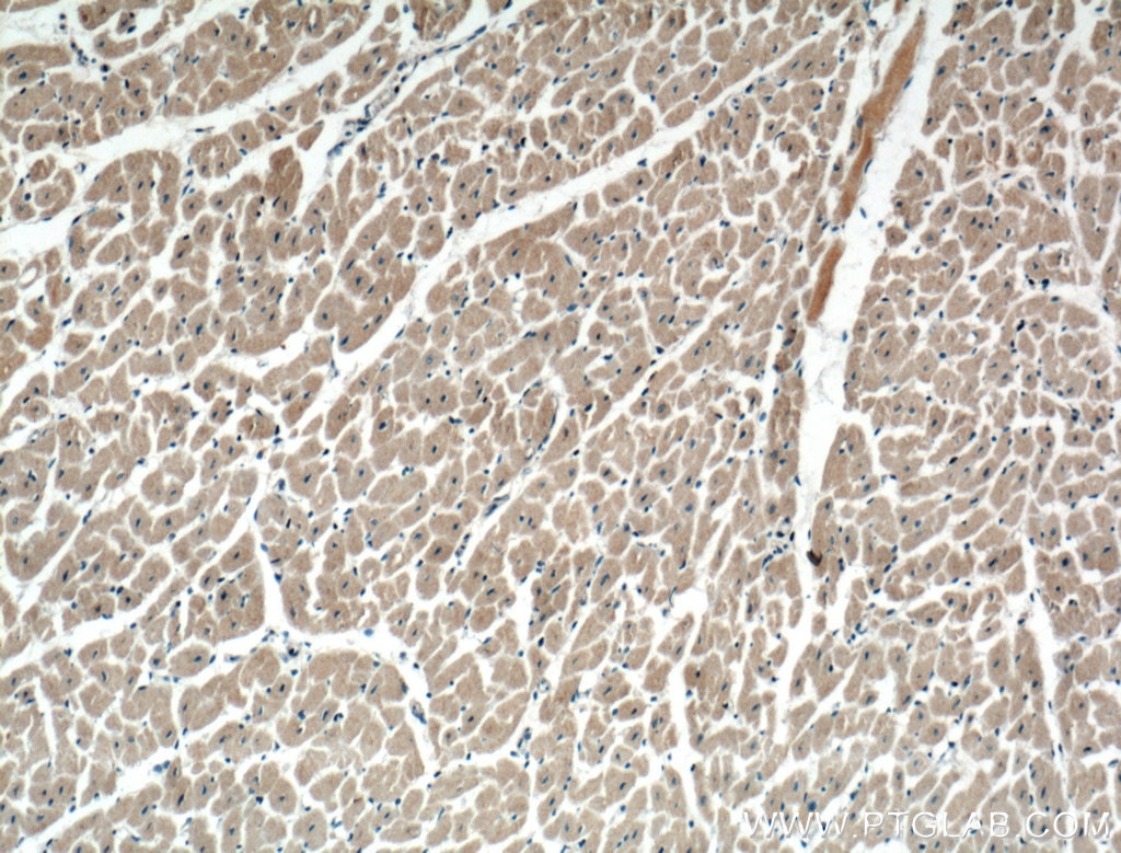 Immunohistochemistry (IHC) staining of human heart tissue using KChIP1 Monoclonal antibody (66439-1-Ig)