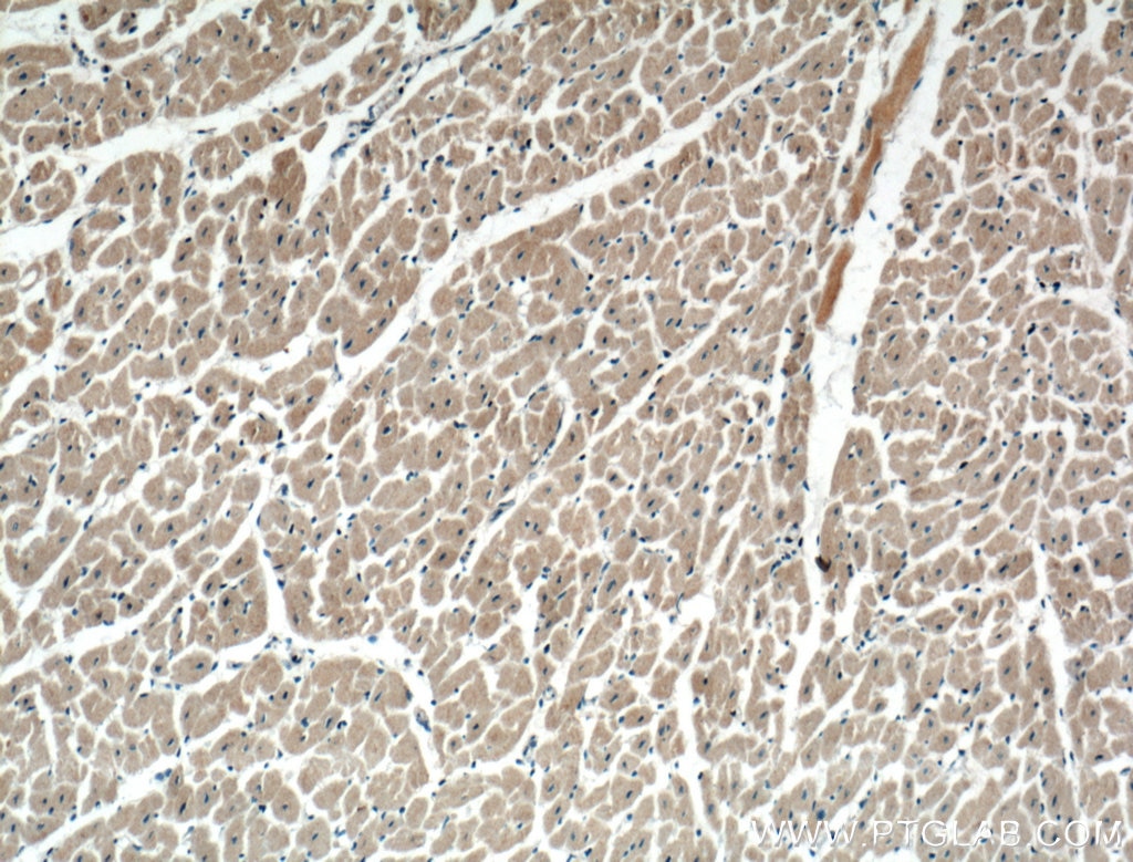 IHC staining of human heart using 66439-1-Ig