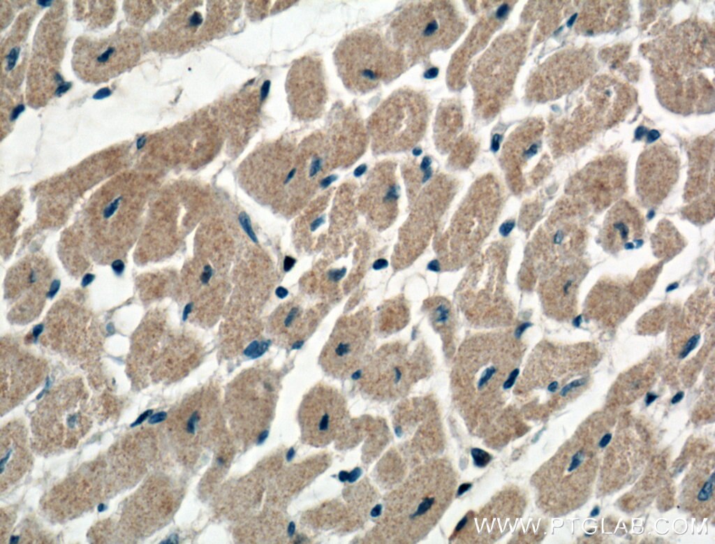 Immunohistochemistry (IHC) staining of human heart tissue using KChIP1 Monoclonal antibody (66439-1-Ig)