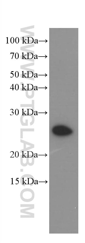 Western Blot (WB) analysis of human spleen tissue using KChIP1 Monoclonal antibody (66439-1-Ig)