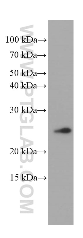 Western Blot (WB) analysis of fetal human brain tissue using KChIP1 Monoclonal antibody (66439-1-Ig)