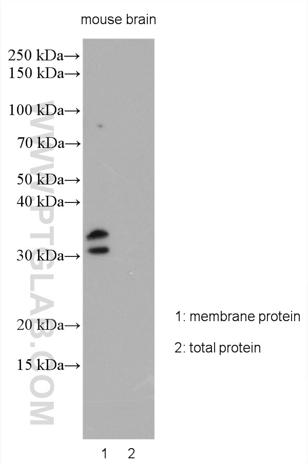 Western Blot (WB) analysis of various lysates using KCNIP2 Polyclonal antibody (20192-1-AP)