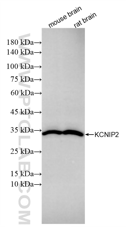 WB analysis using 86696-1-RR (same clone as 86696-1-PBS) Western Blot (WB) analysis of various lysates using KCNIP2 Recombinant monoclonal antibody (86696-1-RR)
