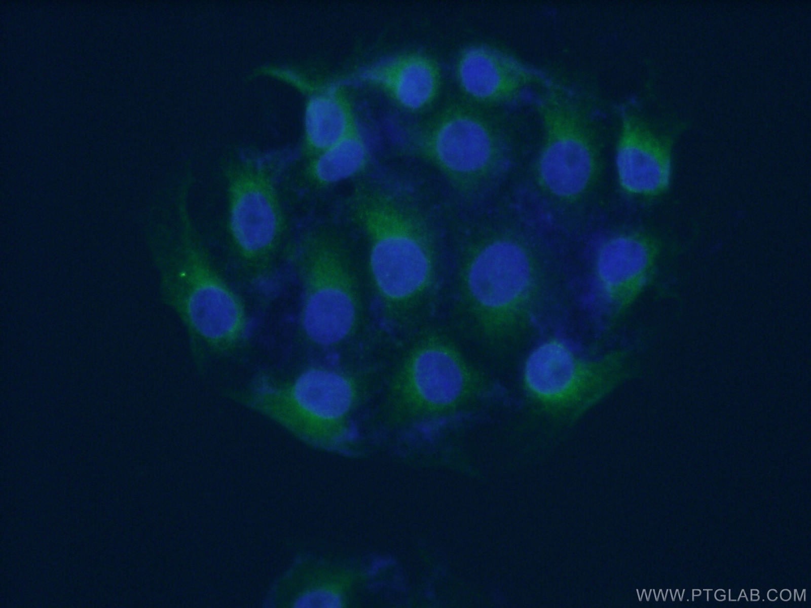 Immunofluorescence (IF) / fluorescent staining of SH-SY5Y cells using KCNIP3 Polyclonal antibody (12032-1-AP)