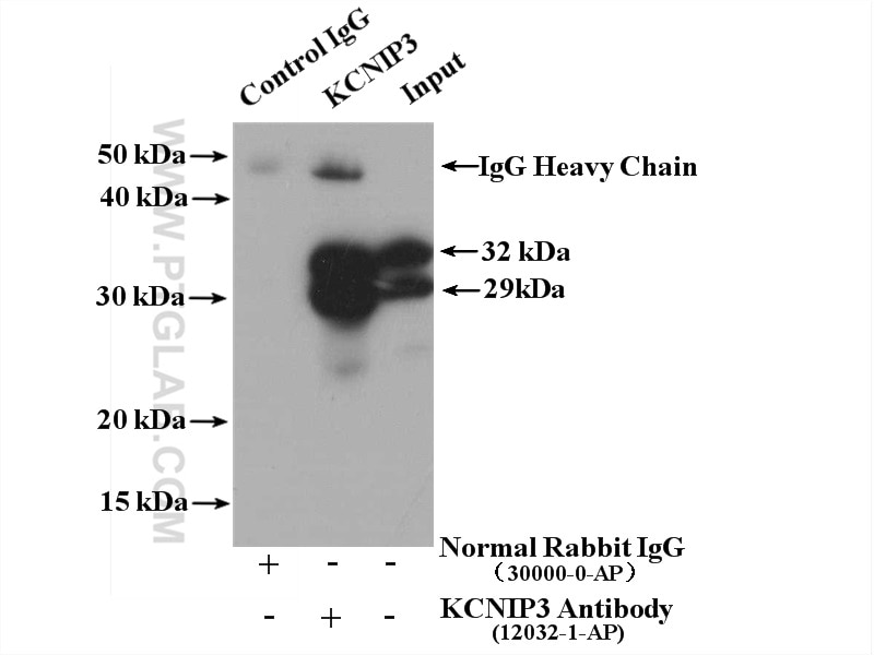 Immunoprecipitation (IP) experiment of mouse brain tissue using KCNIP3 Polyclonal antibody (12032-1-AP)