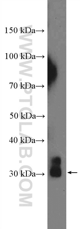 Western Blot (WB) analysis of mouse brain tissue using KCNIP3 Polyclonal antibody (12032-1-AP)