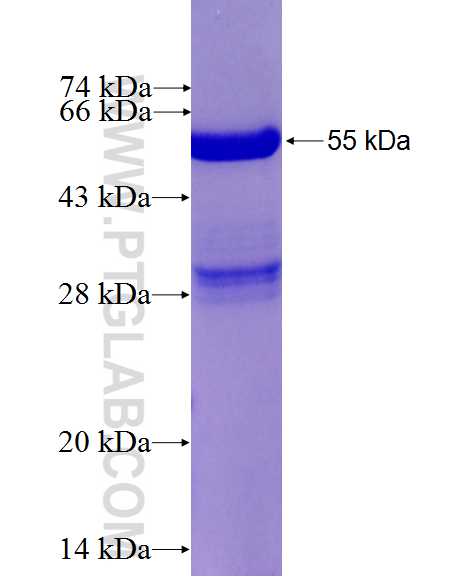 KCNIP3 fusion protein Ag2665 SDS-PAGE