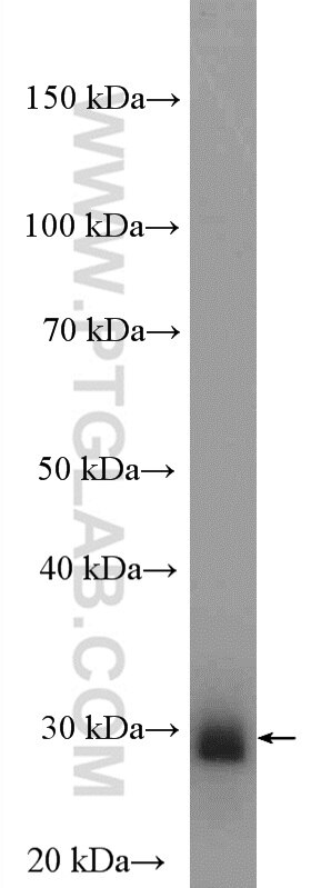 Western Blot (WB) analysis of rat brain tissue using KCNIP4 Polyclonal antibody (13748-1-AP)