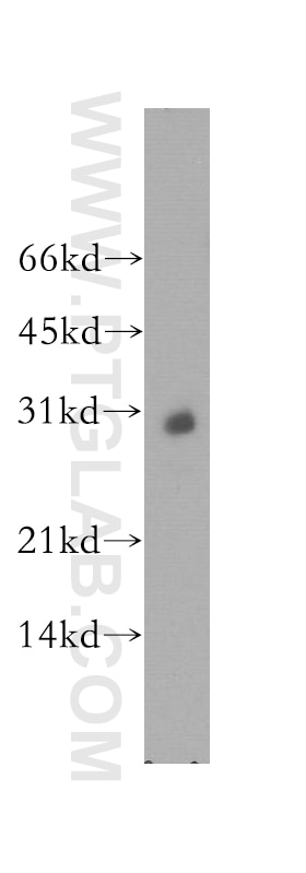 Western Blot (WB) analysis of mouse brain tissue using KCNIP4 Polyclonal antibody (13748-1-AP)