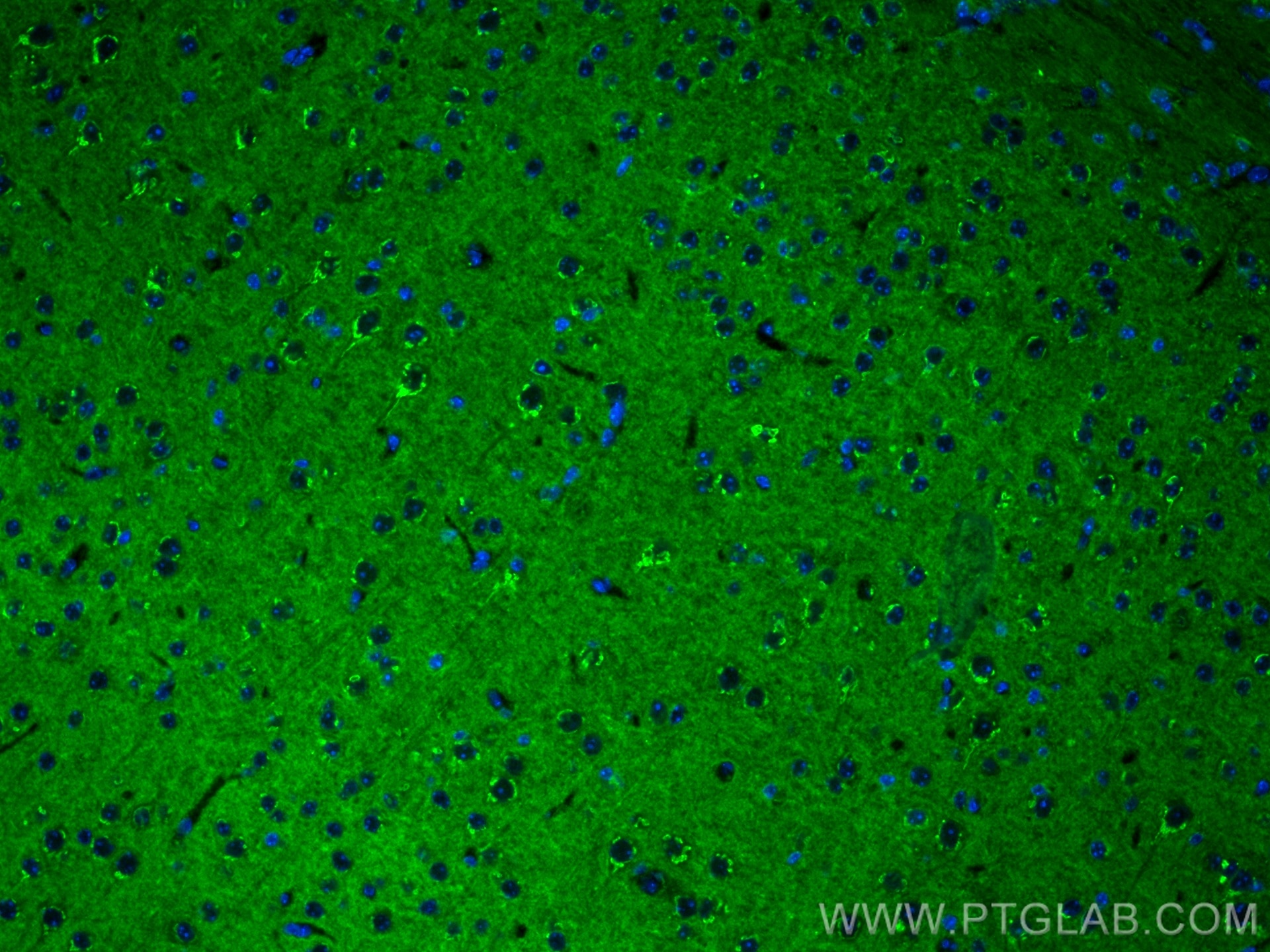 Immunofluorescence (IF) / fluorescent staining of mouse brain tissue using KCNIP4 Monoclonal antibody (60133-1-Ig)