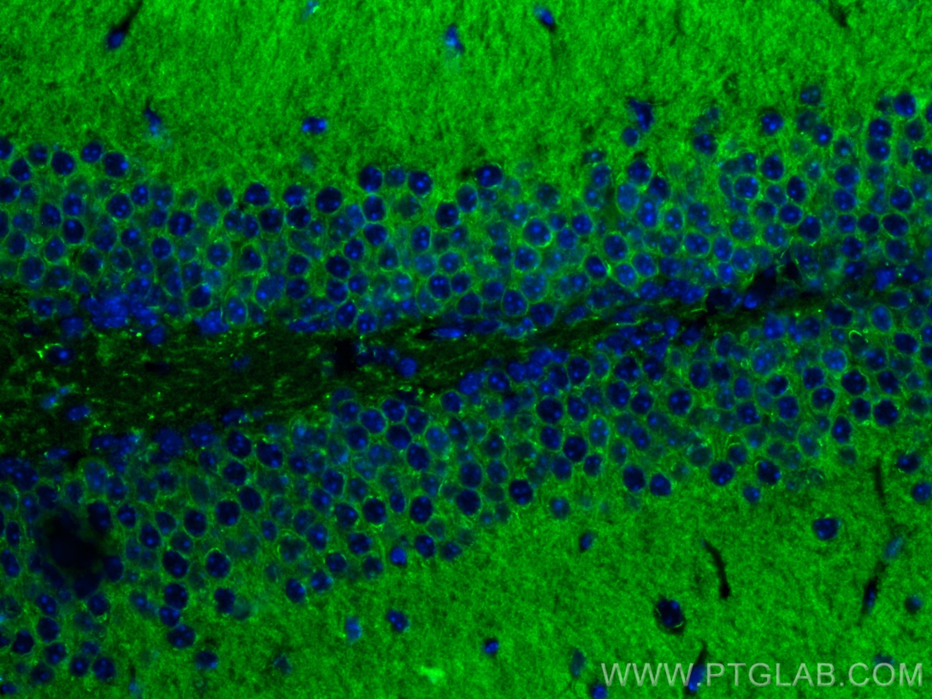 Immunofluorescence (IF) / fluorescent staining of mouse brain tissue using KCNIP4 Monoclonal antibody (60133-1-Ig)