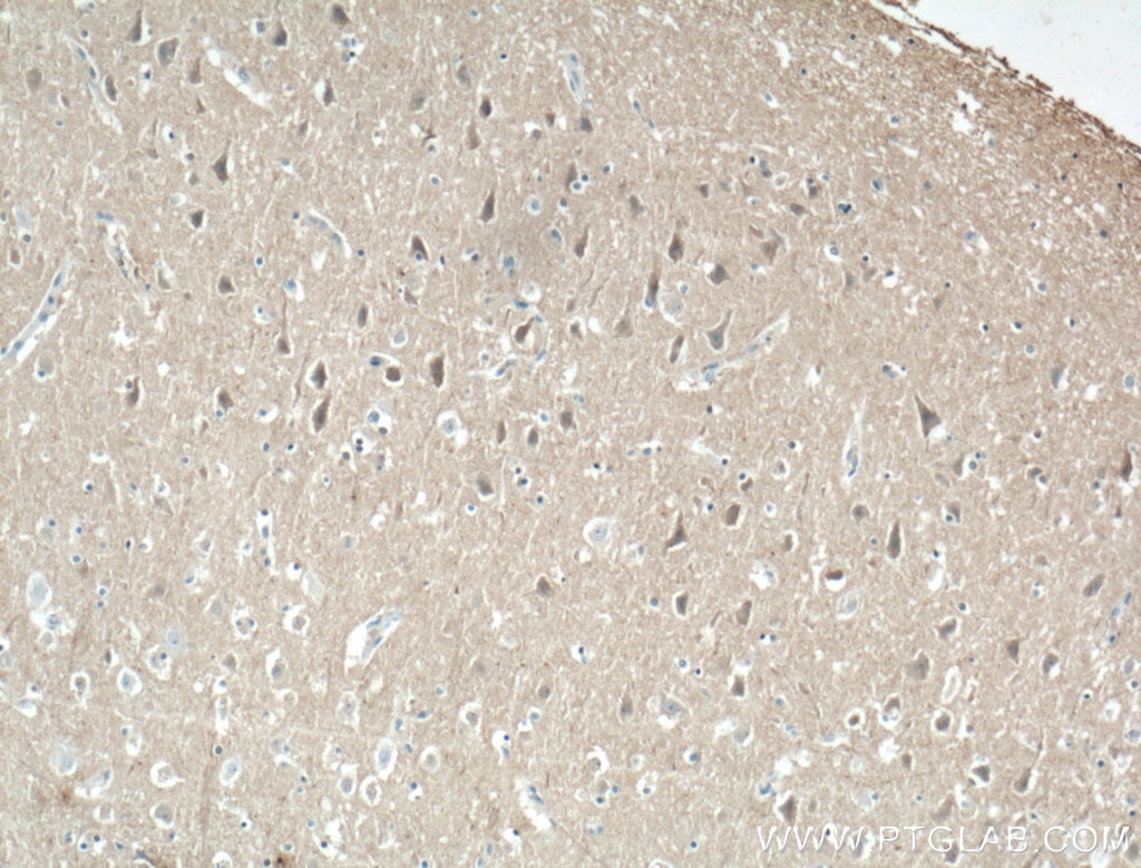 Immunohistochemistry (IHC) staining of human brain tissue using KCNIP4 Monoclonal antibody (60133-1-Ig)