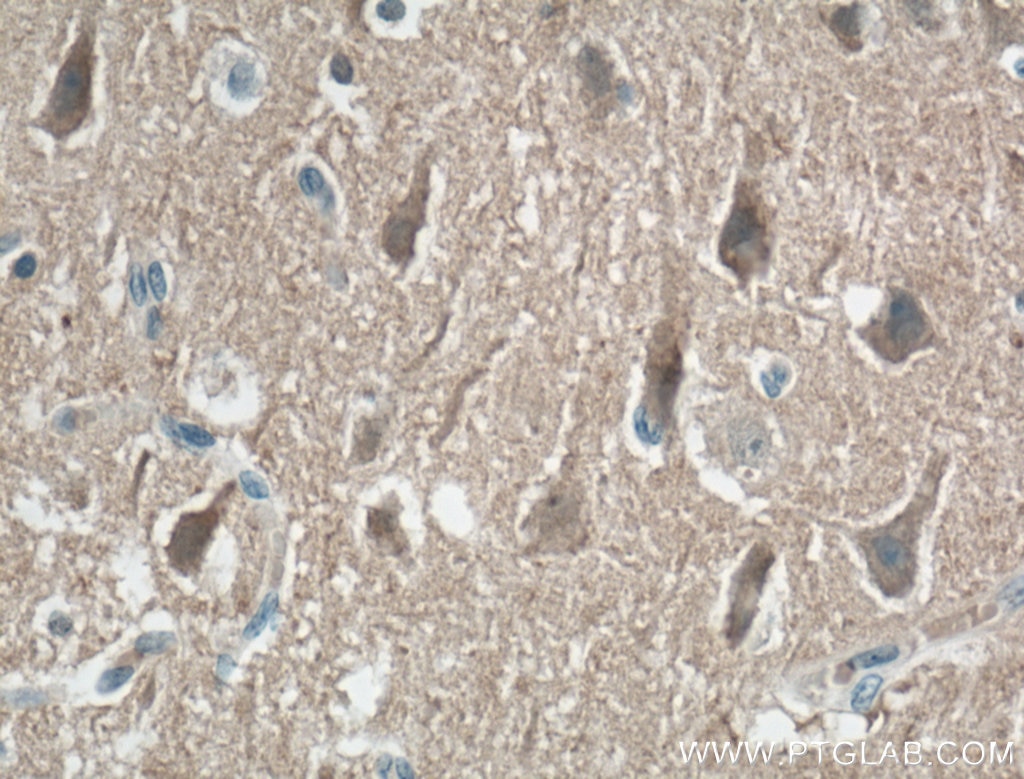 Immunohistochemistry (IHC) staining of human brain tissue using KCNIP4 Monoclonal antibody (60133-1-Ig)