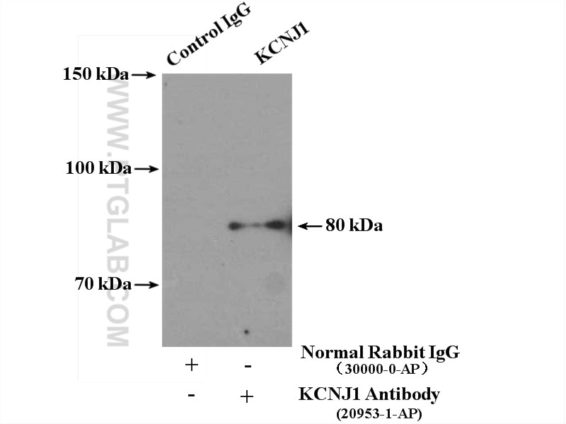 Immunoprecipitation (IP) experiment of mouse brain tissue using KCNJ1 Polyclonal antibody (20953-1-AP)