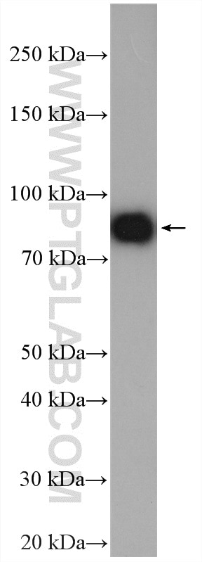 Western Blot (WB) analysis of mouse brain tissue using KCNJ1 Polyclonal antibody (20953-1-AP)