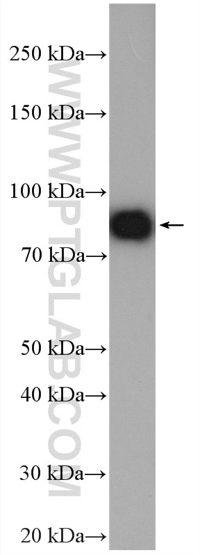 WB analysis of mouse brain using 20953-1-AP