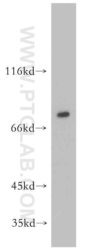 Western Blot (WB) analysis of mouse brain tissue using KCNJ1 Polyclonal antibody (20953-1-AP)