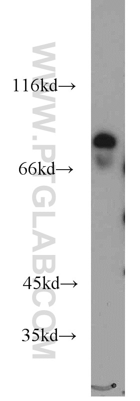 KCNJ1 Polyclonal antibody