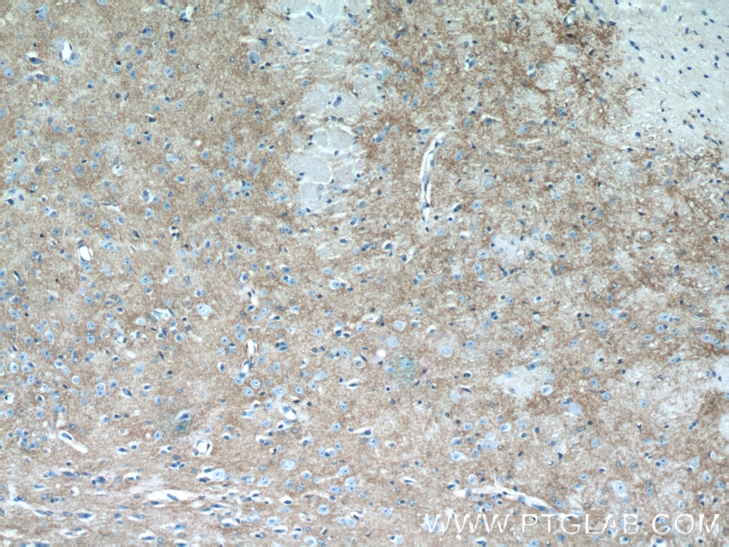 Immunohistochemistry (IHC) staining of mouse brain tissue using Kir4.1 Polyclonal antibody (12503-1-AP)