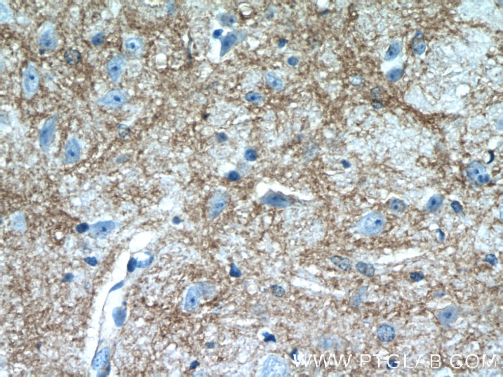 Immunohistochemistry (IHC) staining of mouse brain tissue using Kir4.1 Polyclonal antibody (12503-1-AP)