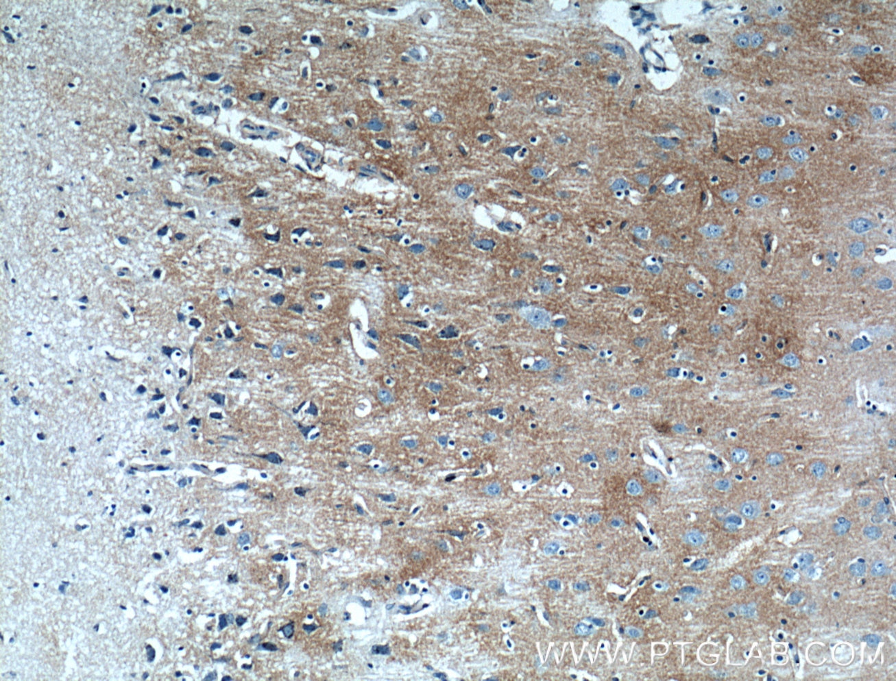 Immunohistochemistry (IHC) staining of human brain tissue using Kir4.1 Polyclonal antibody (12503-1-AP)
