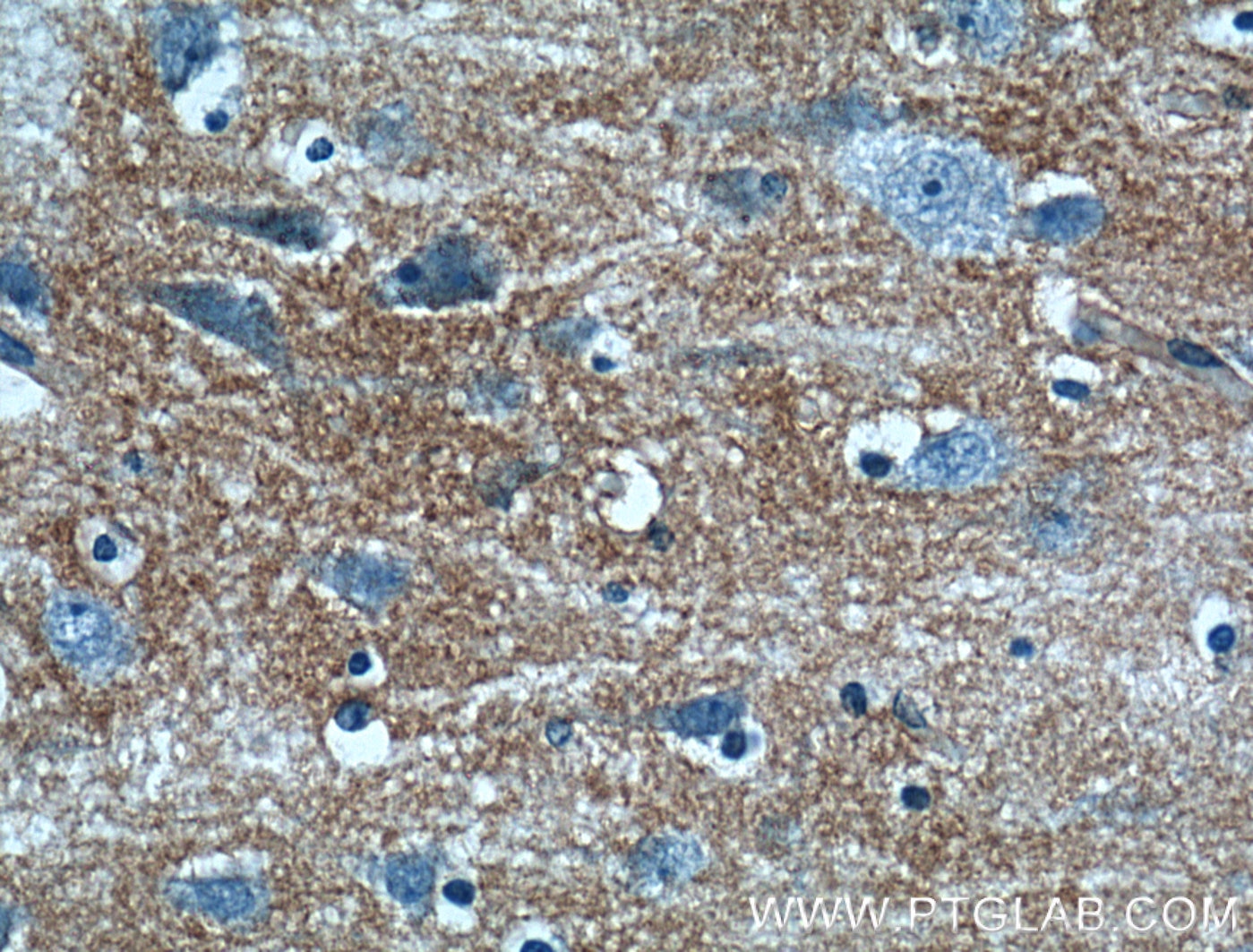 Immunohistochemistry (IHC) staining of human brain tissue using Kir4.1 Polyclonal antibody (12503-1-AP)