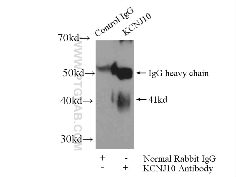IP experiment of rat brain using 12503-1-AP