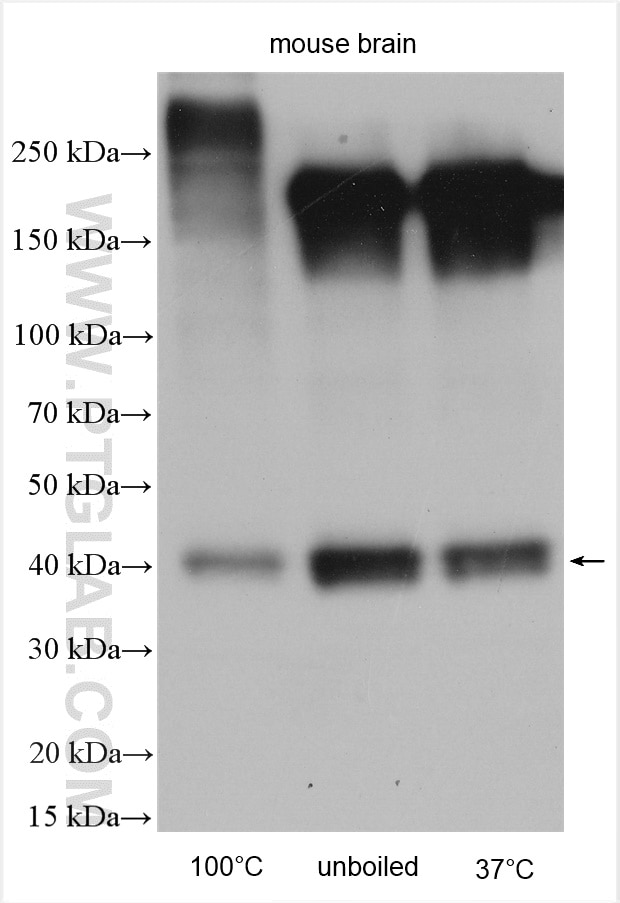 Western Blot (WB) analysis of various lysates using Kir4.1 Polyclonal antibody (12503-1-AP)